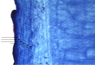 Close-up of small section showing that the bands of cementum are not continuous around the margin of the tooth